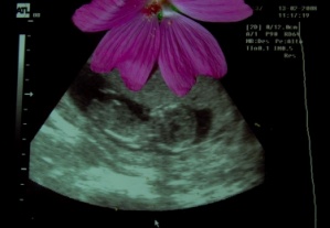 karra env&iacute;anos esta foto titulada "Agromando"