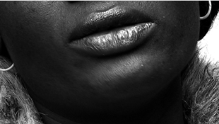 Das 63 pacientes que MSF utilizou para a elaboraci&oacute;n do informe, o 21% eran menores de idade