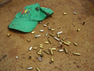 Marcas da violencia empregada polos "pistoleiros" da compa&ntilde;&iacute;a para sacar aos manifestantes da zona ocupada